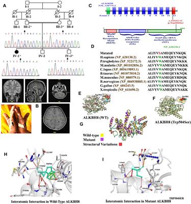 Case Report: Biallelic Variant in the tRNA Methyltransferase Domain of the AlkB Homolog 8 Causes Syndromic Intellectual Disability